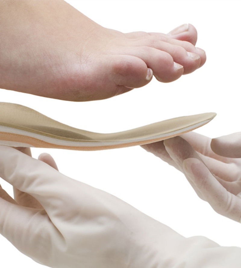 Лікування патологій стопи (деформація, артрози)